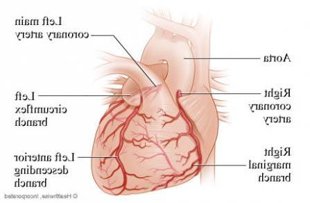 冠状动脉图